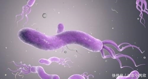 幽门螺旋杆菌阳性怎么办? 这3种食物多吃点, 养胃杀菌, 远离胃病