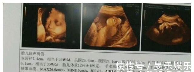 b超单|孕检时,若怀的是男宝宝,多数会有这3种孕检结果,你都符合吗?