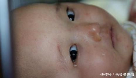 隔夜饭|10岁男孩患肠癌，这三类食物进“黑名单”，医生建议别给孩子吃