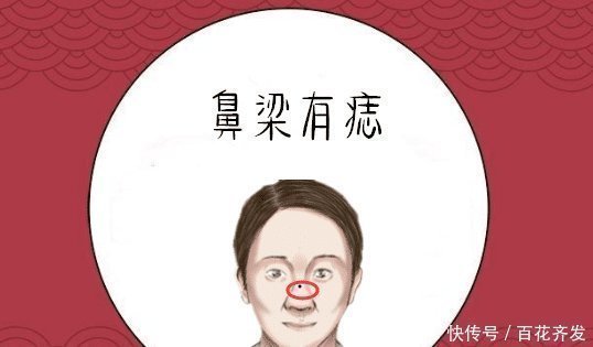 机智过人|身上五颗“财富”痣，福旺财旺身体棒，赚钱容易存款多，一生富贵