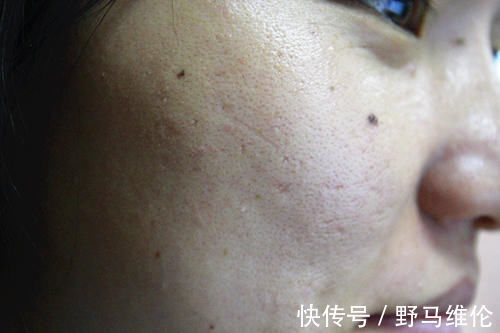 热身|运动，与不运动的人，10年以后，差距会有多大？答案来了