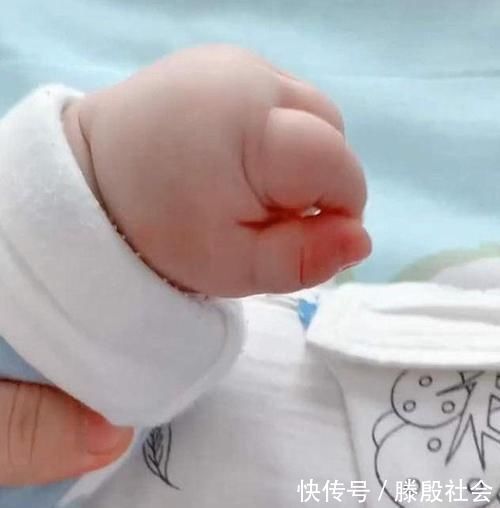 猪蹄|宝妈吐槽宝宝小手像“猪蹄”,看完照片,网友:母乳里加酵母了?