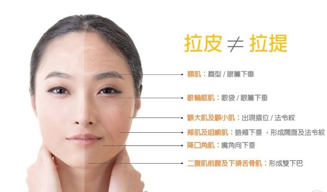 双保险 拉皮手术为什么要植入线或者提拉带?和线雕有什么区别?