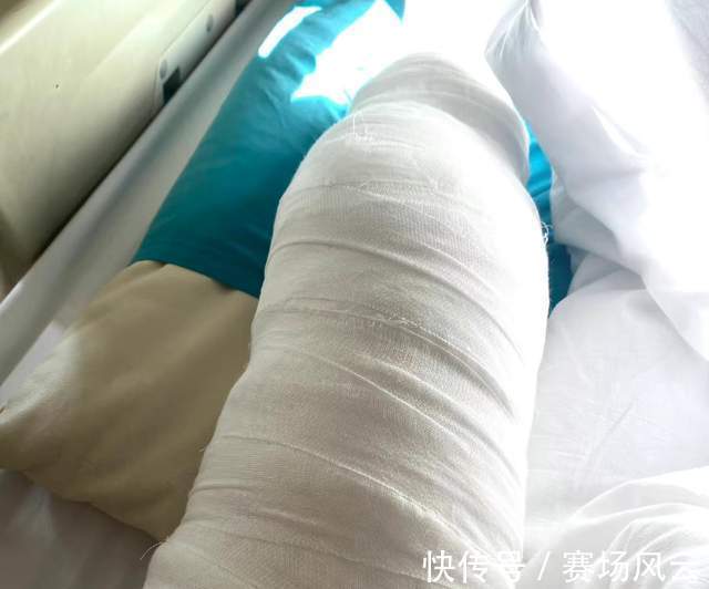 伤病|江苏女排2主力手术成功！王辰玥紧跟张常宁，差点以为蔡斌评论