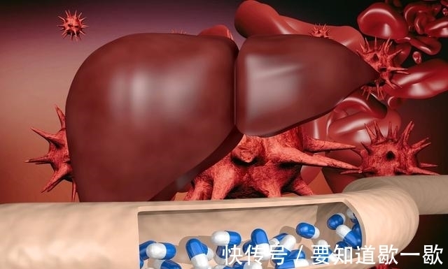 肝硬化|肝硬化不治疗会引起肝衰竭甚至肝癌，一定要做好4点来预防！