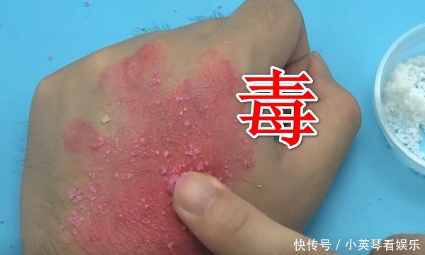 重金属|你用的口红有没有“毒”?只需用“它”搓一搓,立马就能看出来!