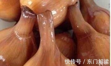 癌细胞|这4种最常见的蔬菜是抗癌“四大天王”,第一种你还天天在吃!