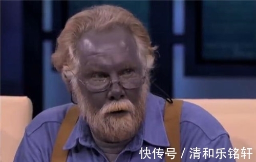 蓝色|地球上尊贵的蓝种人:隐居在6000米的山上,100多年仅露面了一次