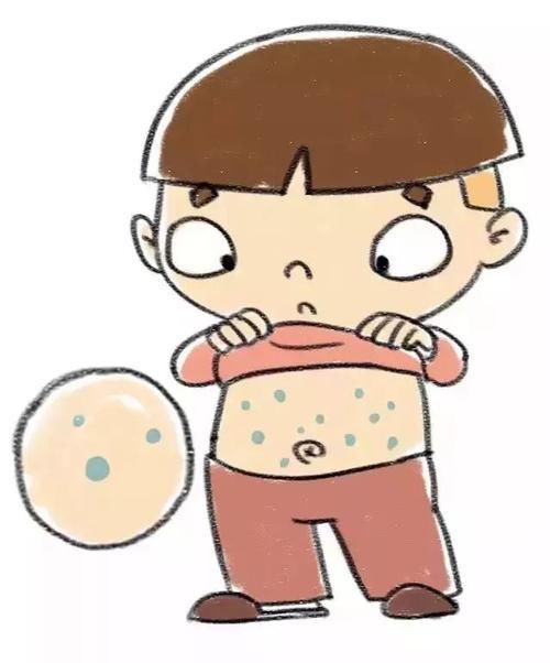水痘|得了水痘就是出几个痘痘那么简单？孩子要不要打疫苗？