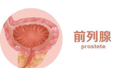 前列腺癌|为何男人的前列腺会成为多事之地做好哪些事,可以养护前列腺