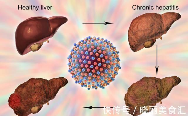 肝细胞|转氨酶、胆红素都升高,医生说没事,肝功能检查单怎么看?