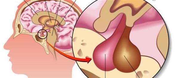 身高|雷纳尔:前半生是1米22的侏儒,后半生是2米16的巨人,他经历了啥