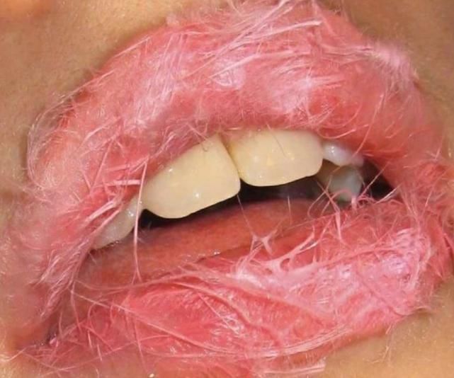 公认最丑的3大“唇形”,第2种是女生的最爱,直男照照镜子吧