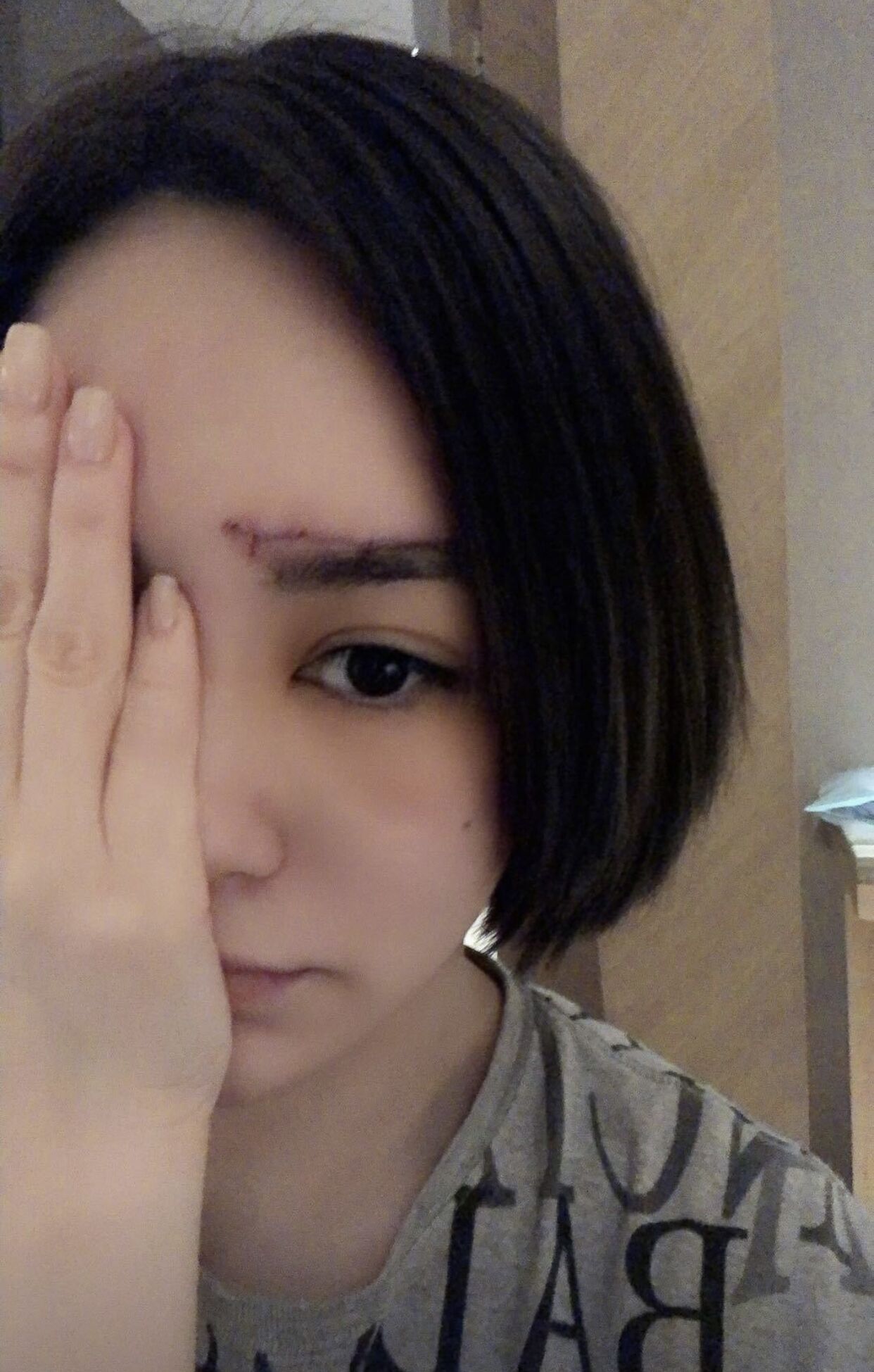 生活中难免会受伤,不过明星作为公众人物,很多时候都是要"靠脸吃饭"