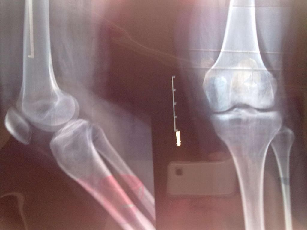 辣妈|生完孩子长高了2CM,为啥怀孕还能长高孕妈不妨看看