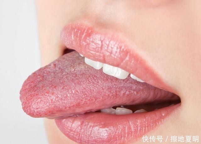 血管|血管堵塞严重,身上的2处发硬,做好一点,血管感激你