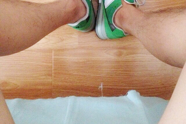 激光脱毛|为什么有的男人腿毛旺盛，而有的却“光秃秃”原因有哪些