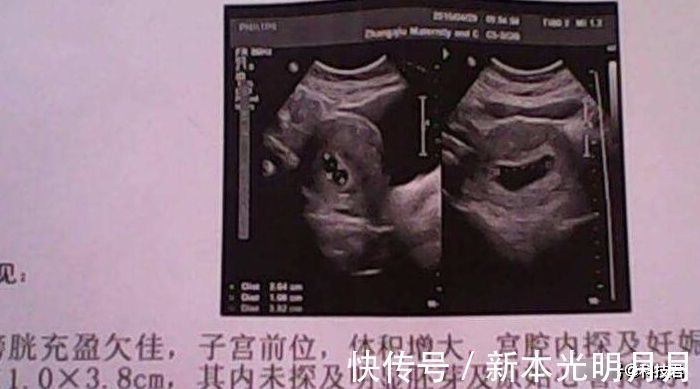 产检|产检时,孕妈若符合四种情况,可能怀的是一位“小王子”