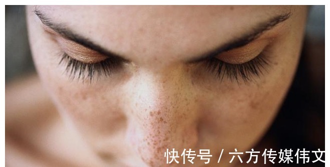 雀斑|你的护肤方法真的做对了吗?这五个护肤误区,希望你没有中招!