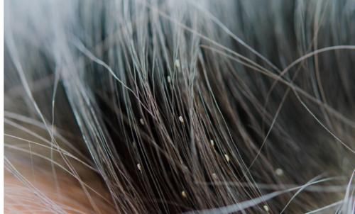 祛濕|濕氣重，肝火旺！9種食材煮水喝，祛濕降火，肚子平了，氣色好了