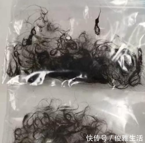 肚子疼|3岁女孩总喊肚子疼，父母带她去医院检查，取出的东西令家长崩溃