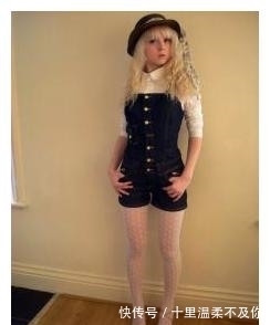 体重|身高1米7,体重54公斤,甜美女孩嫌自己胖,手术扎胃瘦到76