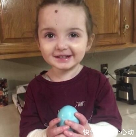 lily|3岁女孩患怪病,摸一下都有可能被杀,妈妈天天把她包成木乃伊