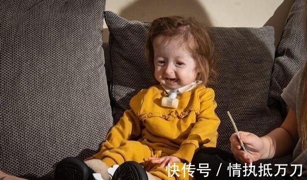 伊利斯|2岁女童看起来像80岁,病情独特全球首例,网友:希望返老还童