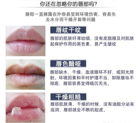 孕期明星榜润唇膏大盘点!理肤泉修复力强,曼秀雷敦孕妇慎用