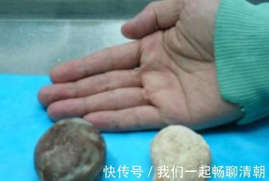 小知识|红薯和“它”是冤家，若共同食用，可能会助长细胞病变，早知早好