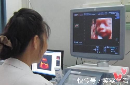 四维彩超|老公陪孕妈做四维,结果不让进,为啥四维检查贴着“家属止步”?