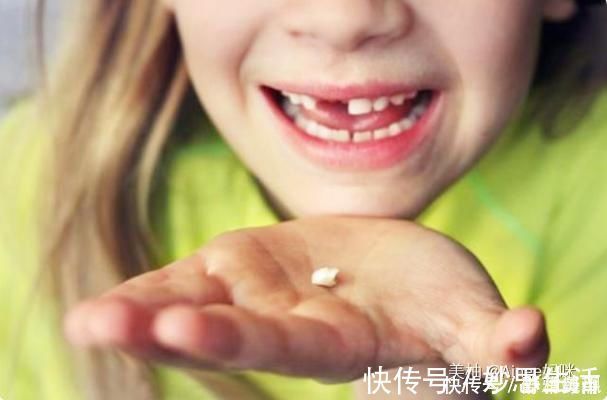 人的一生|孩子乳牙整齐漂亮,换牙后却越来越“歪”可能是这几点没做好
