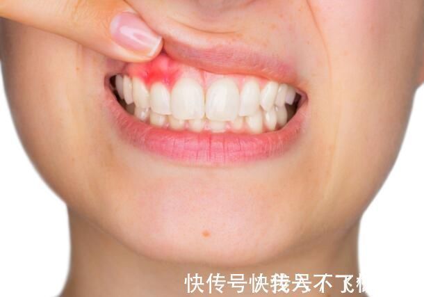 脂肪泻|以下几个症状可能是癌发出的信号,如果你能抓住,或许就能活命