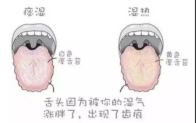 要点|补脾胃是治疗一切疾病的关键!夏天补脾的要点都在这里了!