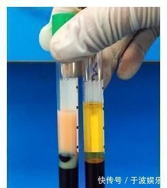 男孩|8岁男孩抽出“牛奶血”,原因和妈妈有关,医生不该让孩子乱吃