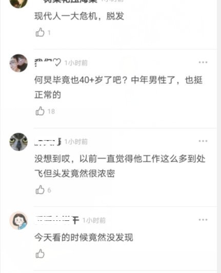 47歲何炅顏值翻車?頭部禿頂狀態差,不老男神真的老了嗎?