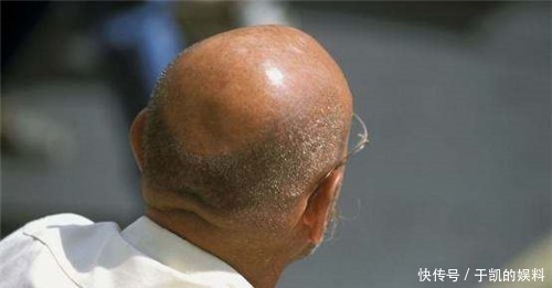 放光|俗语:穷人脚上无毛,富人头顶放光,讲的是啥?老祖宗的慧眼识人