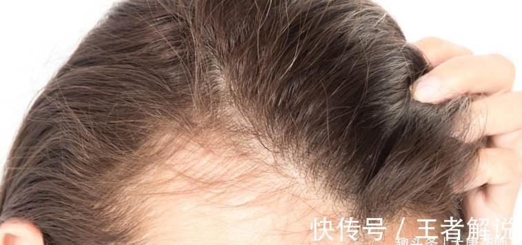 妙方|一个大气磅礴的妙方，血府逐瘀丸，学会妙用，横扫全身各种疾病！