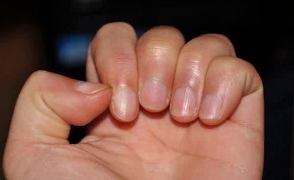 健康|男人肾不好“看手”，若手上没有这3个“表现”，恭喜肾脏还健康