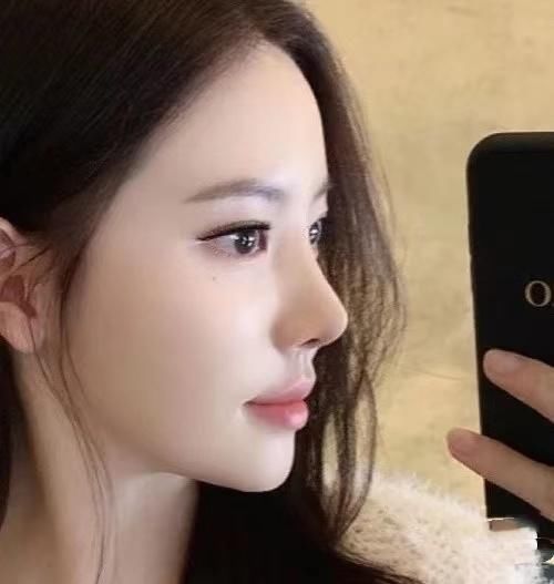 瘦脸|瘦鼻子的有效方法是什么?几个小方法,让鼻子更小巧