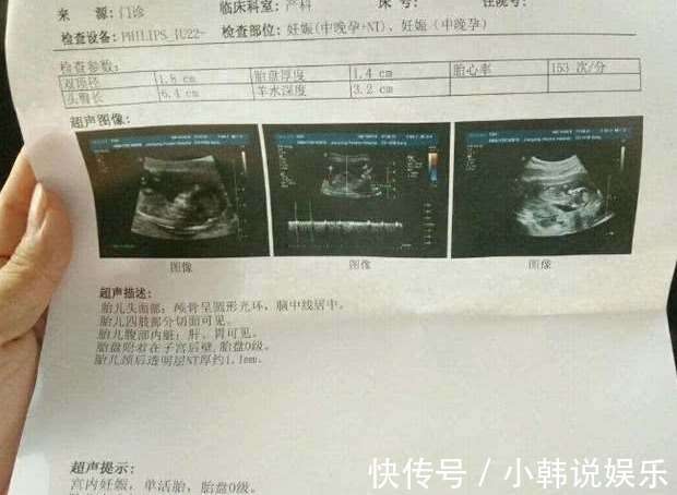 股骨长|B超单上的3个“数据”,真幸运,可能怀了个“小棉袄”即将驾到