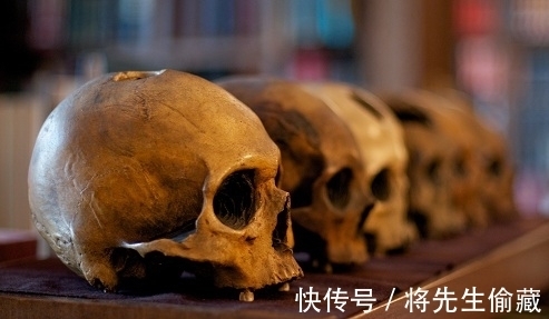 开颅手术&《山海经》中的“巫族”普遍存在于上古时期,史前文明真的存在?