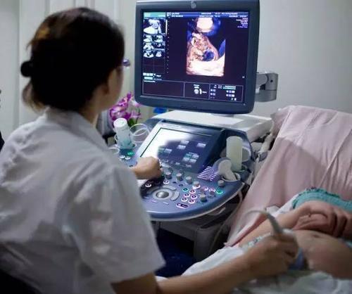 检查|儿媳妇去医院检查,发现孩子有“小尾巴”,婆婆听后不禁乐出声