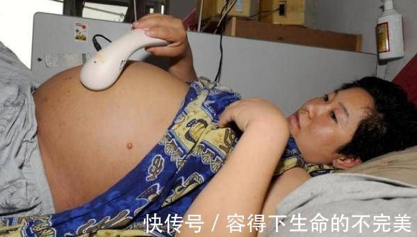 怀孕|产科医生告诉你,这5种情况一定是剖腹产不是每个怀孕的母亲都能生孩子