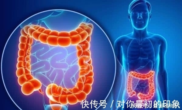 大肠癌|“肠癌”一经发现就是晚期？上厕所时，3个“情况”早预防