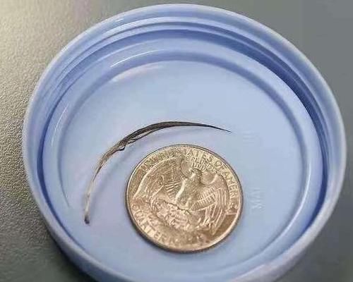 餐具|宝宝脖子长羽毛,家长当过敏治,医生说出原因家长吓出一身汗