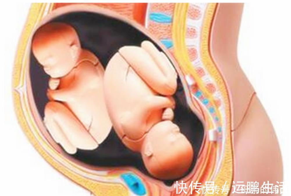 产妇|怀孕后多久,胎位就要固定了?这个孕周前,孕妈还能“调乾坤”