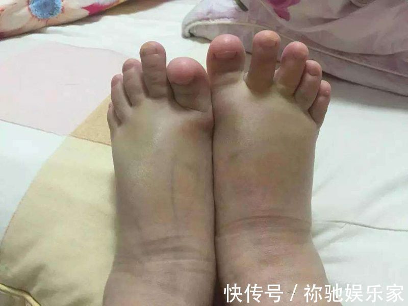 宝宝|孕晚期这3件“尴尬事”,是胎儿在释放健康信号,孕妈不用紧张