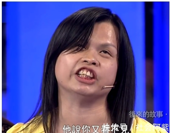 “盲版邓丽君”张玉霞：依靠好声音走红，成名后被强制整容