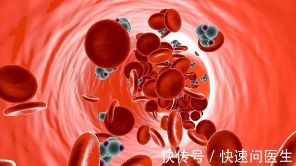 医生|原位癌是癌症吗?浸润癌、原发癌有什么不一样?医生的答案很清楚